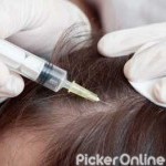 Alopecia Treatment Center