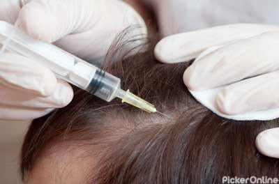 Alopecia Treatment Center