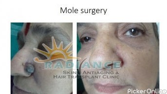 Radiance Skin Antiaging And Hair Transplant Clinic
