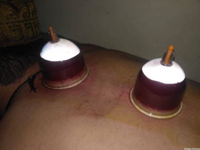 Al ASHHAR CLINIC (HIJAMA CENTRE & UNANI PHYSICIAN IN NAGPUR)