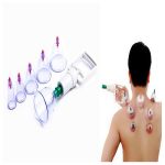 Cupping Therapy Clinic